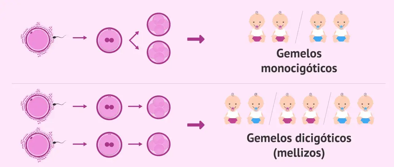 Ilustración de la concepción y desarrollo de gemelos monocigóticos y dicigóticos. Los gemelos diferentes pueden ser idénticos o no.