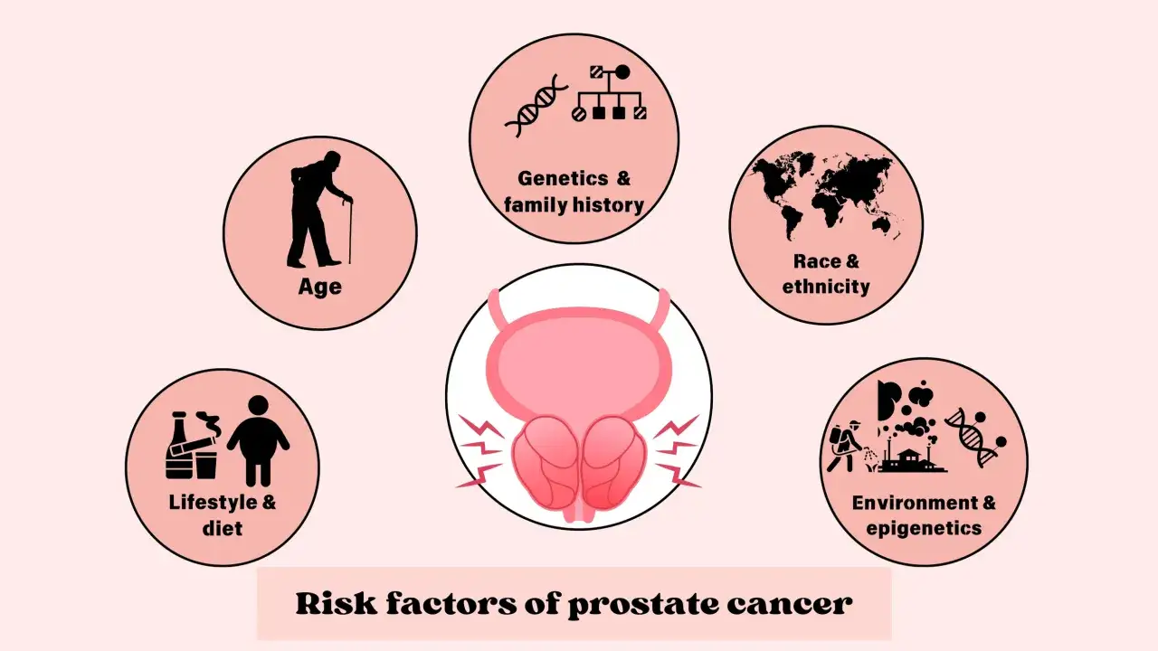 Factores de riesgo de c&aacute;ncer de pr&oacute;stata: edad, estilo de vida, raza, ambiente y gen&eacute;tica. El c&aacute;ncer de pr&oacute;stata es hereditario.