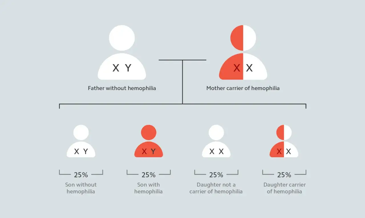 Diagrama de herencia del genotipo humano para la hemofilia. Padre XY sin hemofilia, madre XX portadora. Hijos: 25% varón sin hemofilia, 25% varón con hemofilia, 25% hija no portadora, 25% hija portadora.